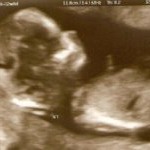 All Akimbo: Baby picture!
