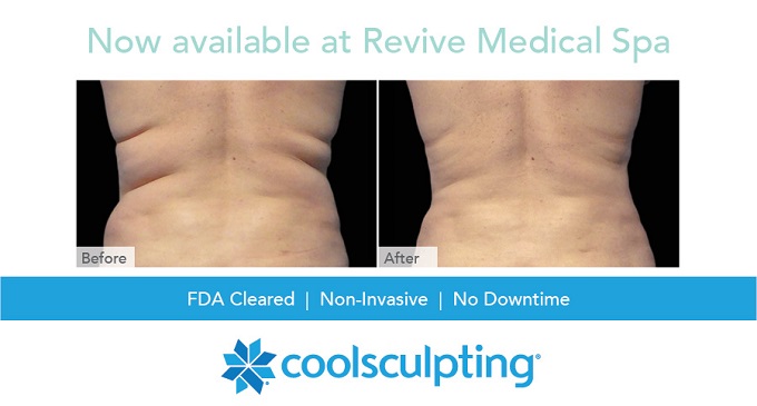 Coolsculpting Revive Medical Spa